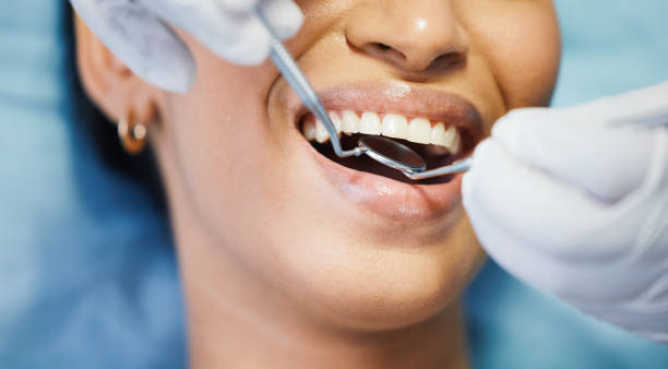 Best Emergency Wisdom Teeth Removal in Kahaluu, HI